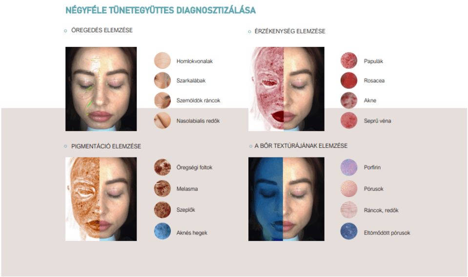 Négy különböző tünetre bontott elemzési képernyő.